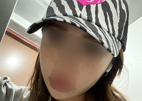 여태 한 성형 중 젤 맘에 들음