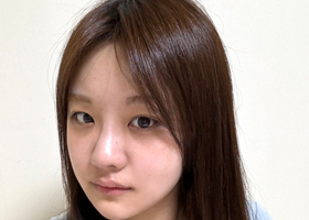 윤곽삼종하고 얼굴형이 많이 변했어요!