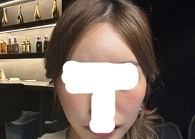 광대 축소하고 얼굴이 너무 작아졌어요~~>