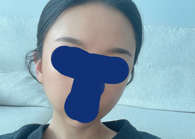 레전드 광대축소 후기