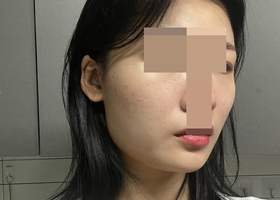윤곽 3종 4개월 후기임돠