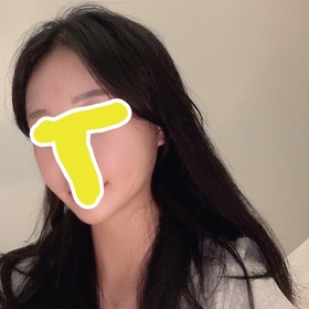 윤곽3종 볼턱지방흡입 3개월