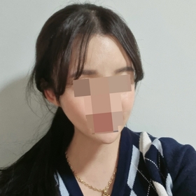 턱끝재수술, 비스포크v라인, 얼굴 이중턱지흡
